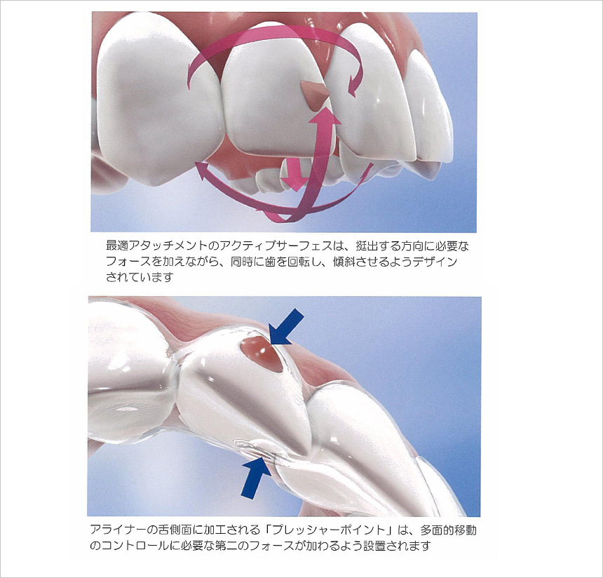 予測実現性の向上