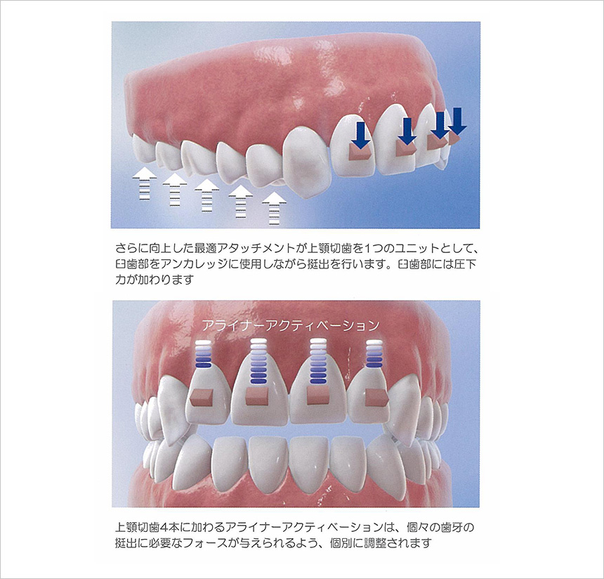 臨床結果の向上を追求