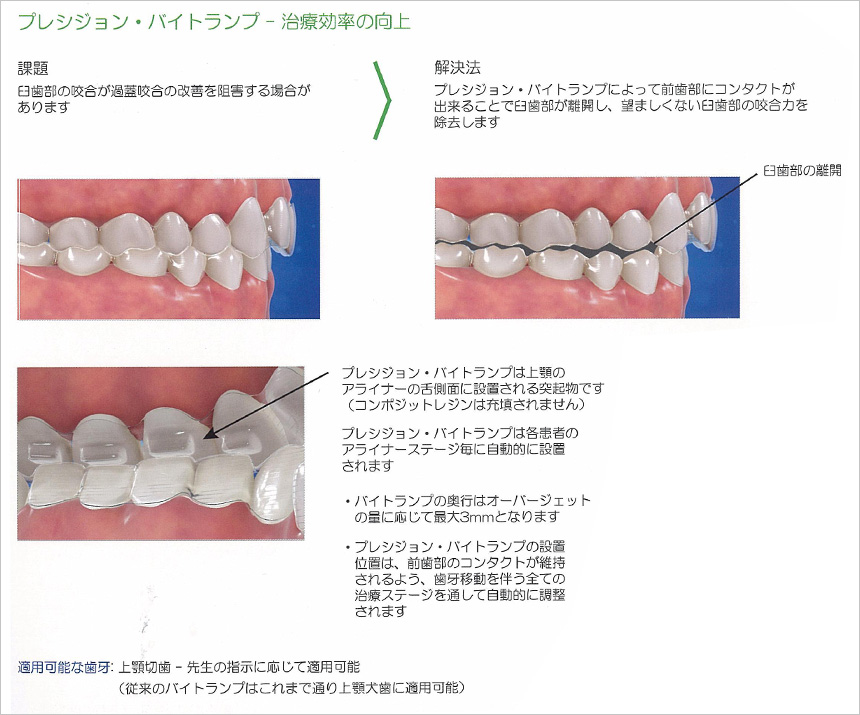 治療効率の向上